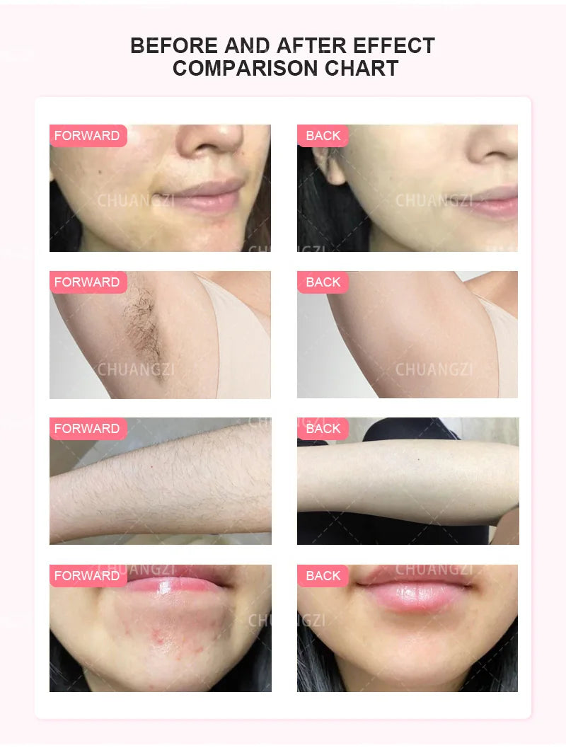 TAIXL Beauty Salon Portable IPL Hair Removal Laser Machine Diode Laser Permanent Hair Removal