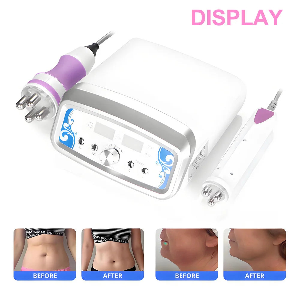 Mychway Mini 2in1 Multipolar Facial Wrinkle Removal Machine